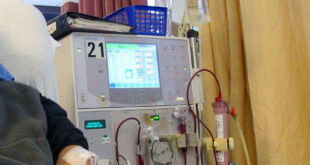 Dialysis